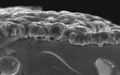 Kestcells_-_Kestcells_eu